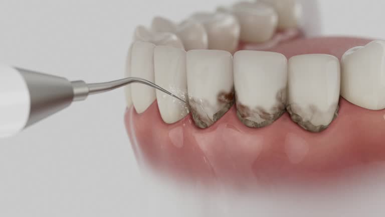 Trusted Teeth Cleaning And Checkup service in Middletown, VA - Dentist Open Now